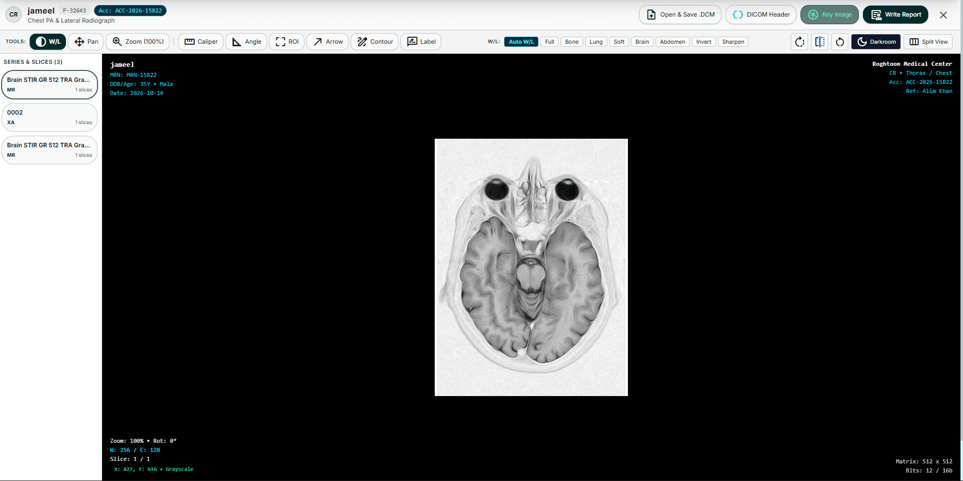 Web DICOM Radiology Viewer & Worklist